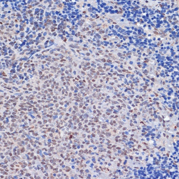 PARP1 Antibody