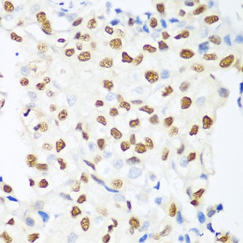 HDAC1 Antibody