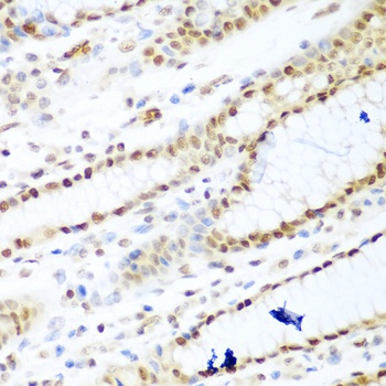 HDAC1 Antibody