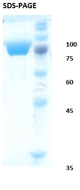 Hepatitis C virus (HCV) core/NS3/NS4/NS5 Recombinant Protein
