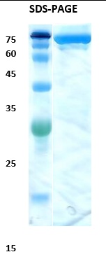 Hepatitis C virus (HCV) core/NS3 Recombinant Protein