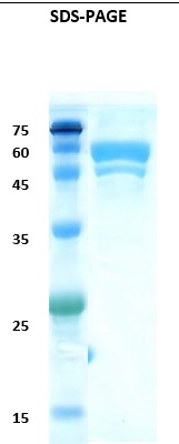 Hepatitis A virus (HAV) chimeric Recombinant Protein