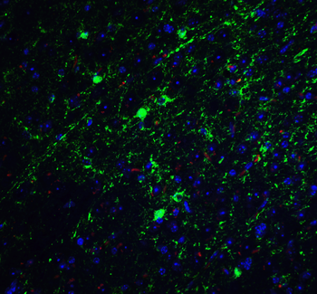 GLUL Antibody