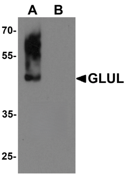 GLUL Antibody