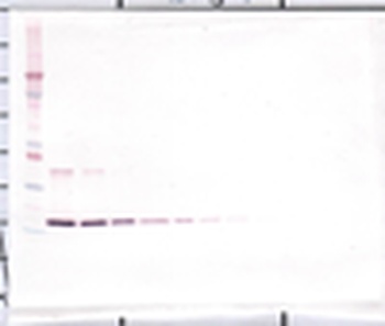 Il12a , Il12b Antibody