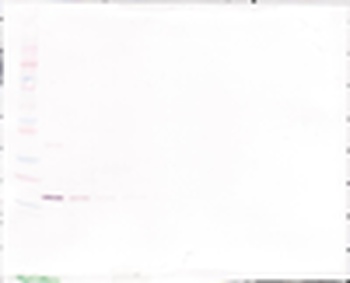 IL12A , IL12B Antibody