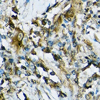NLRP1 Rabbit Polyclonal Antibody