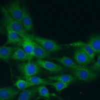 NLRP1 Rabbit Polyclonal Antibody