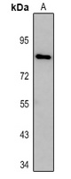 DTX3L Rabbit Polyclonal Antibody