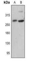 FASN Rabbit Polyclonal Antibody