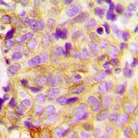 FASN Rabbit Polyclonal Antibody