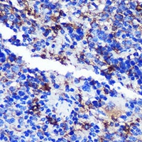 CD68 Rabbit Polyclonal Antibody