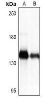 Collagen 1 alpha 1 Rabbit Polyclonal Antibody