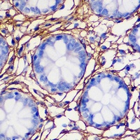 Collagen 1 alpha 1 Rabbit Polyclonal Antibody