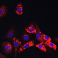 Collagen 1 alpha 1 Rabbit Polyclonal Antibody