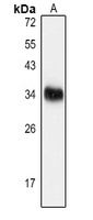 GDF15 Rabbit Polyclonal Antibody