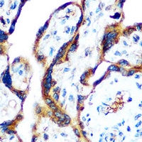 GDF15 Rabbit Polyclonal Antibody