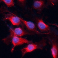 VEGFA Rabbit Polyclonal Antibody