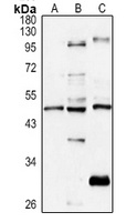 CCR3 Rabbit Polyclonal Antibody