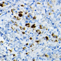 CCR3 Rabbit Polyclonal Antibody