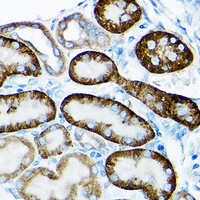 SIRT3 Rabbit Polyclonal Antibody