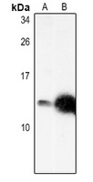 CXCL12 Rabbit Polyclonal Antibody