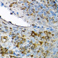 CXCL12 Rabbit Polyclonal Antibody