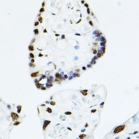 TEAD1 Rabbit Polyclonal Antibody