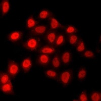 TEAD1 Rabbit Polyclonal Antibody