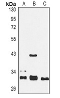 SIRT3 Rabbit Polyclonal Antibody