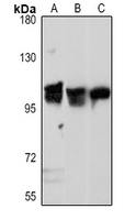 IREB2 Rabbit Polyclonal Antibody