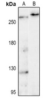 LRRK2 Rabbit Polyclonal Antibody