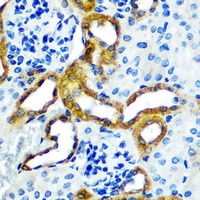 LRRK2 Rabbit Polyclonal Antibody