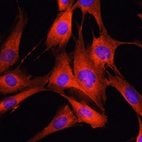 LRRK2 Rabbit Polyclonal Antibody