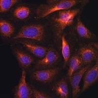 GAD1 Rabbit Polyclonal Antibody
