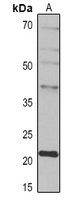 IL-10 Rabbit Polyclonal Antibody