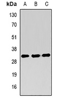 RING1b Rabbit Polyclonal Antibody