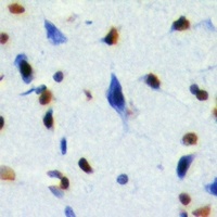 RING1b Rabbit Polyclonal Antibody