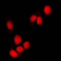RING1b Rabbit Polyclonal Antibody