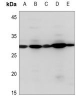 PDGFB Rabbit Polyclonal Antibody