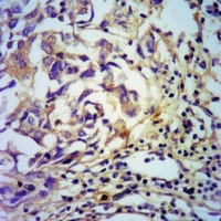 PDGFB Rabbit Polyclonal Antibody