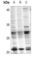 RAB21 (Acetyl-K109) Rabbit Polyclonal Antibody