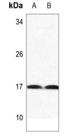 Histone H3 (MonoMethyl-K122) Rabbit Polyclonal Antibody