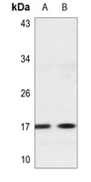 Histone H3 (MonoMethyl-K56) Rabbit Polyclonal Antibody