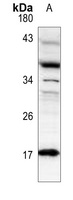 Histone H3 (DiMethyl-K79) Rabbit Polyclonal Antibody