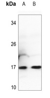 Histone H3 (MonoMethyl-K27) Rabbit Polyclonal Antibody