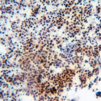 Histone H3 (MonoMethyl-K27) Rabbit Polyclonal Antibody