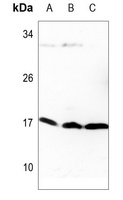 Histone H3 (TriMethyl-K9) Rabbit Polyclonal Antibody