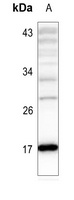 Histone H3 (Acetyl-K4) Rabbit Polyclonal Antibody
