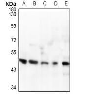 IL-1R2 Rabbit Polyclonal Antibody